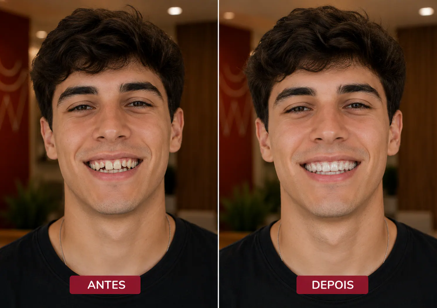 Transformação odontológica em retrato comparativo — Sobilis Odontologia Humanizada